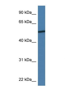 Polyclonal Rabbit anti-Human ADIPOR2 Antibody (aa48-97, WB)