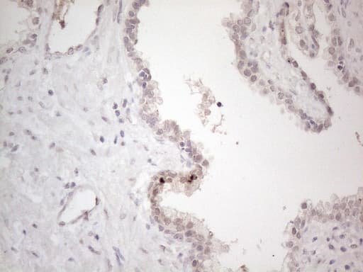 CTBP2 Antibody (aa233-336, clone OTI4D4)