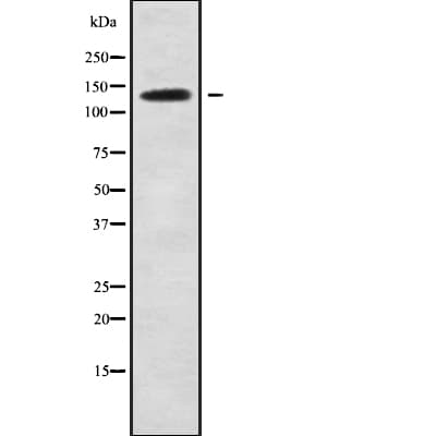 SLC4A2 / AE2 Antibody