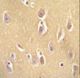 Polyclonal Rabbit anti-Human OR13J1 Antibody (aa244-272, IHC, WB)