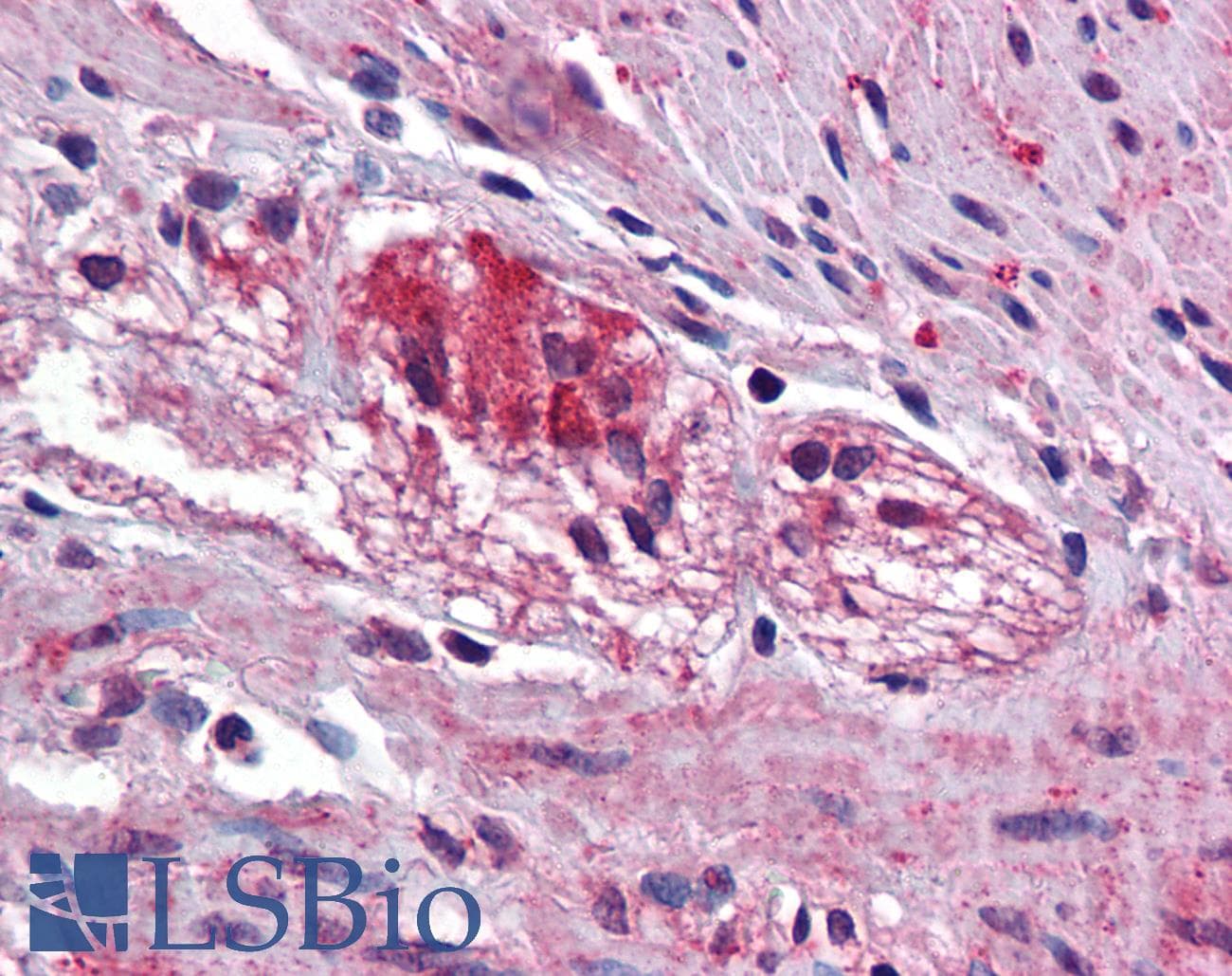 KCTD15 Antibody (aa36-85)