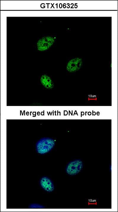 Polyclonal Rabbit anti-Human QIP1 / KPNA4 Antibody (aa459-521, IHC, WB)