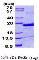 Human SEC22B Protein (Recombinant His)