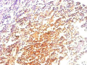 Monoclonal Mouse anti-Human B2M / Beta 2 Microglobulin Antibody (clone 2D3E5, IHC)