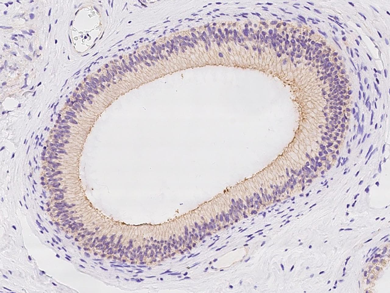 SLC6A18 / XTRP2 Antibody