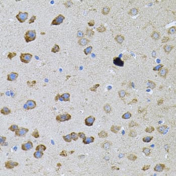 PFKP Antibody