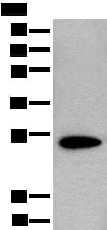 CD63 Antibody
