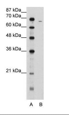 FGA / Fibrinogen Alpha Antibody (N-Terminus)