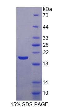 Human AMACR / P504S Protein (Recombinant His-T7, N-terminus)