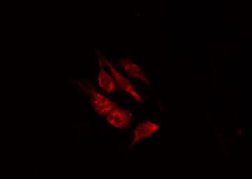 OR8B2+3 Antibody