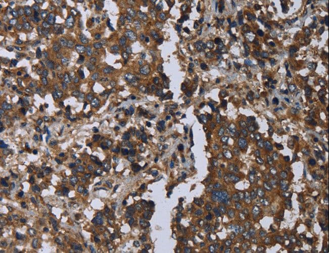 GOLGA2 / GM130 Antibody