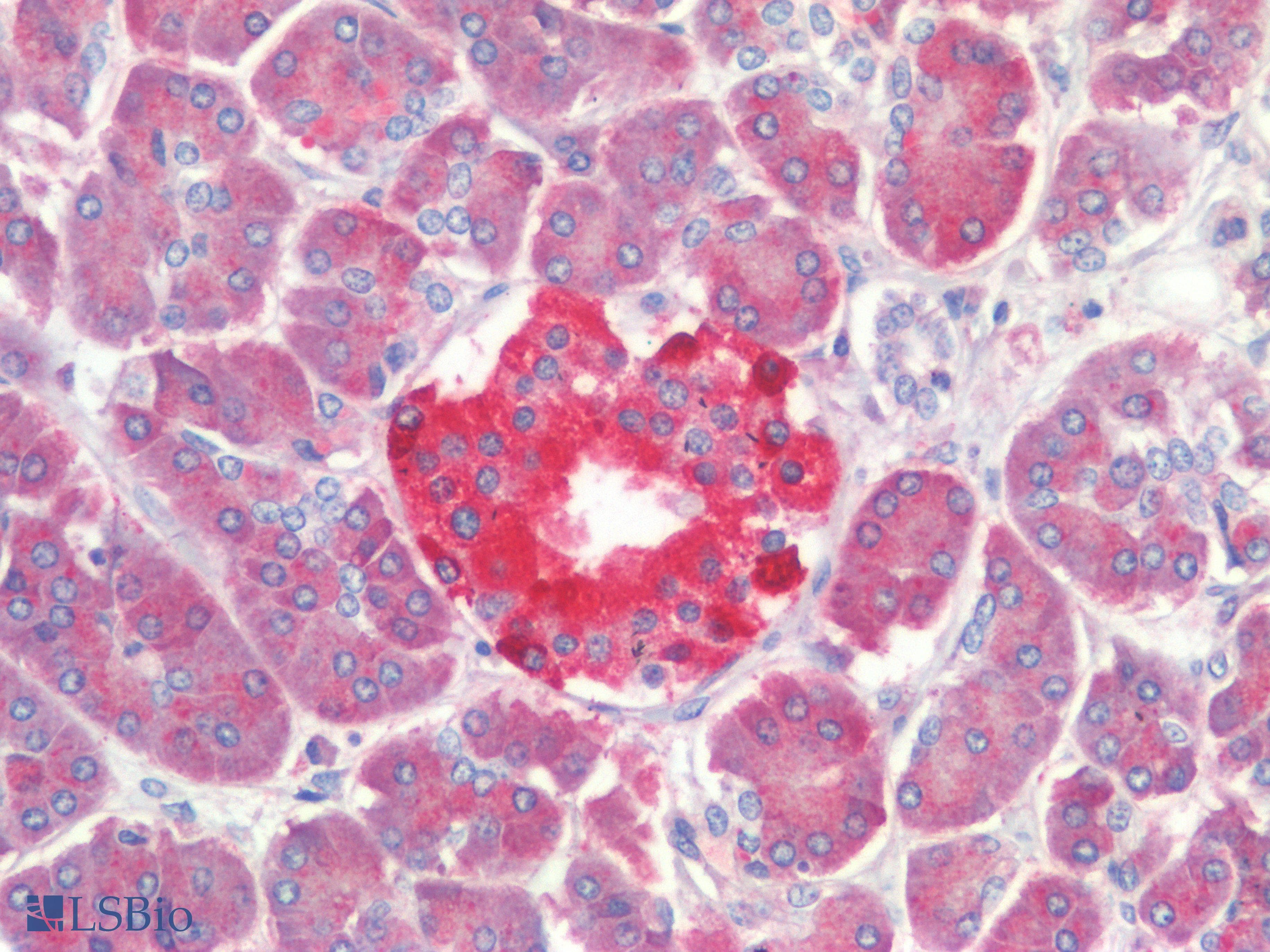 PathPlus™ PTP1B Antibody