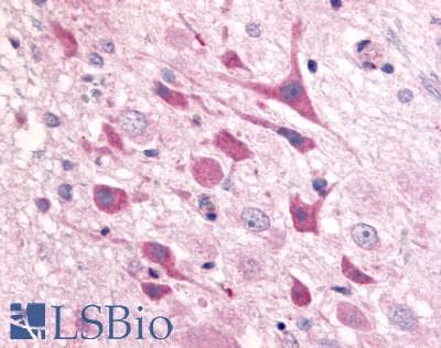 IHC-plus™ Polyclonal Rabbit anti-Human ADORA1 / Adenosine A1 Receptor Antibody (Extracellular Domain, IHC)