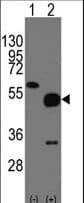 IHC-plus™ NPTX2 Antibody (aa309-338)
