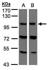 Polyclonal Rabbit anti-Human VPS11 Antibody (aa300-392, WB)