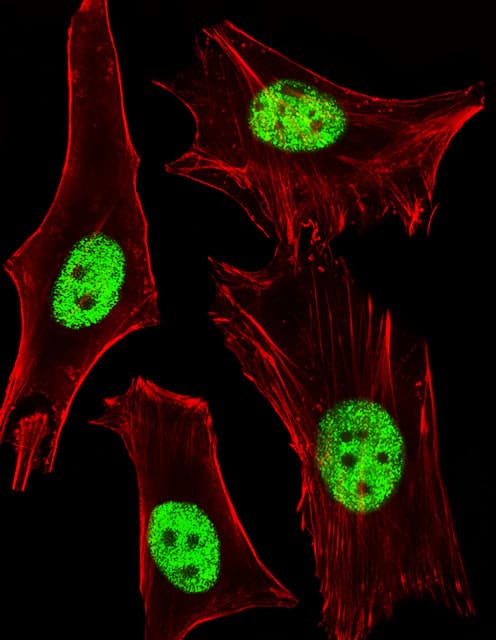 Monoclonal Mouse anti-Human PPARA / PPAR Alpha Antibody (clone 1331CT894.186.143, IHC, IF, WB)