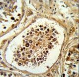 Polyclonal Rabbit anti-Human EGLN2 / PHD1 Antibody (aa194-221, IHC, WB)