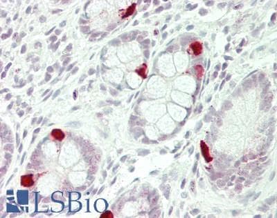 IHC-plus™ PPP1CA / PP1-Alpha Antibody
