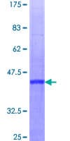 Human RBBP6 Protein (Recombinant GST)