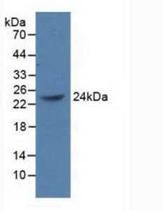 BMI1 / PCGF4 Antibody (aa152-289)