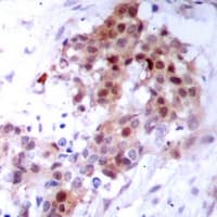 Polyclonal Rabbit anti-Human MAPK14 / p38 Antibody (Internal, IHC, WB)