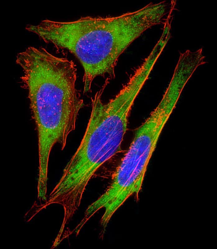 RPS10 / Ribosomal Protein S10 Antibody (C-Terminus)
