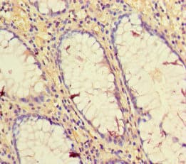 Polyclonal Rabbit anti-Human CD34 Antibody (IHC, IF, WB)