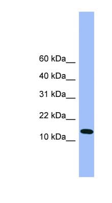 ATP5D Antibody (C-Terminus)