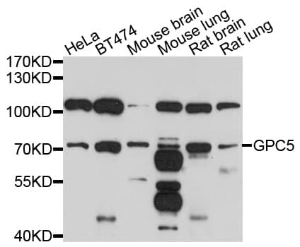 GPC5 / Glypican 5 Antibody