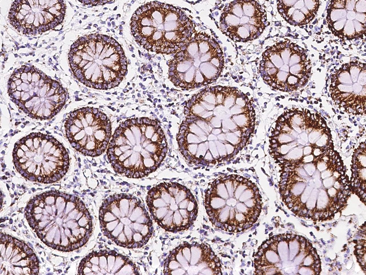 Polyclonal Rabbit anti-Human MRPL12 Antibody (IHC, IF, WB)