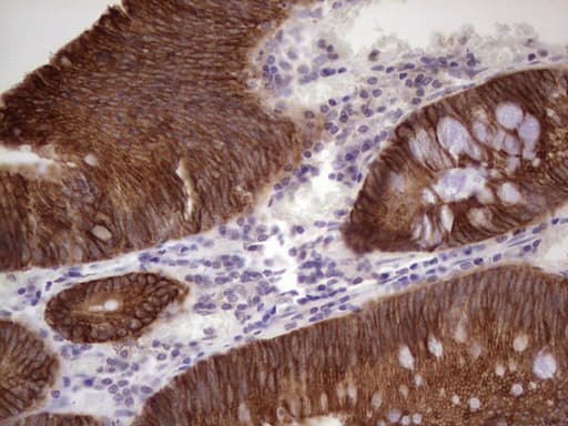 KRT19 / CK19 / Cytokeratin 19 Antibody (aa240-390, clone OTI5B11)