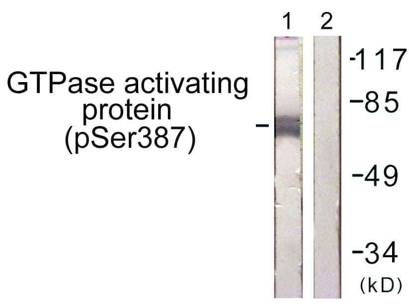 Polyclonal Rabbit anti-Human RACGAP1 / MGCRACGAP Antibody (phospho-Ser387, IHC, IF, WB)