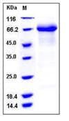 Human IL12RB1 / CD212 Protein (Recombinant His,C-terminus)