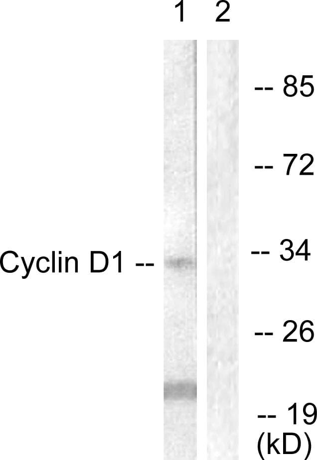 Polyclonal Rabbit anti-Human CCND1 / Cyclin D1 Antibody (p286, IHC, WB)