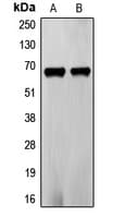 Polyclonal Rabbit anti-Human FZD5 / Frizzled 5 Antibody (C-Terminus, IHC, WB)