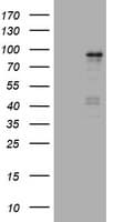Monoclonal Mouse anti-Human NBN / Nibrin Antibody (clone OTI1C9, WB)