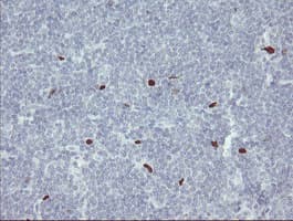 Monoclonal Mouse anti-Human MAFB Antibody (clone OTI2A6, IHC, WB)