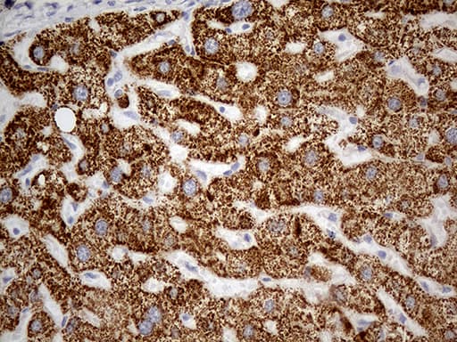 OTC Antibody (aa33-354, clone OTI8H9)