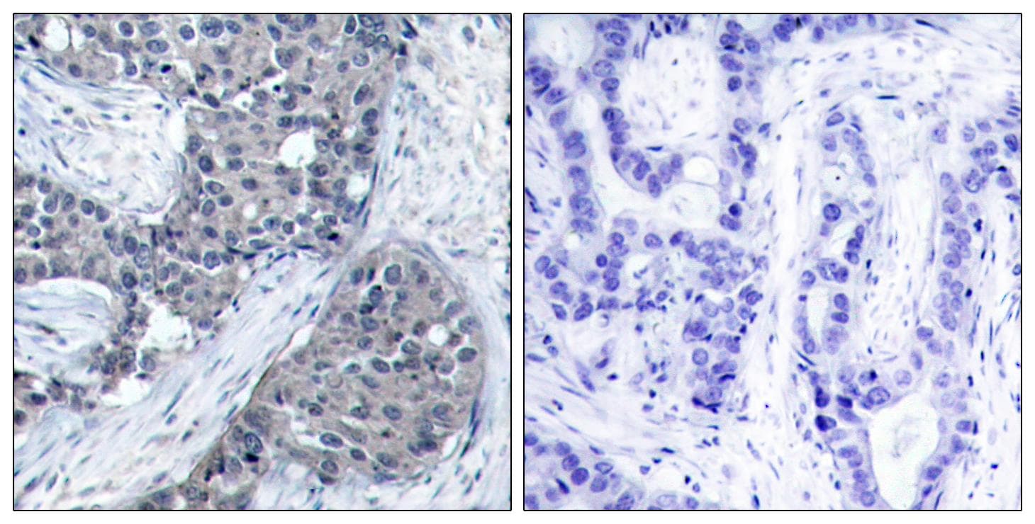 EIF4E Antibody (phospho-Ser209)