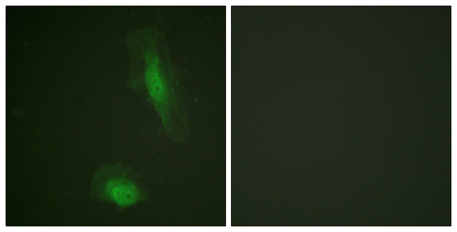 IHC-plus™ Polyclonal Rabbit anti-Human AKT1 Antibody (aa95-144, IHC, IF, WB)