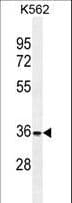 FOXI3 Antibody (aa157-186)