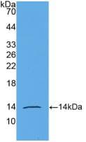 AMH / Anti-Mullerian Hormone Antibody (aa453-560)