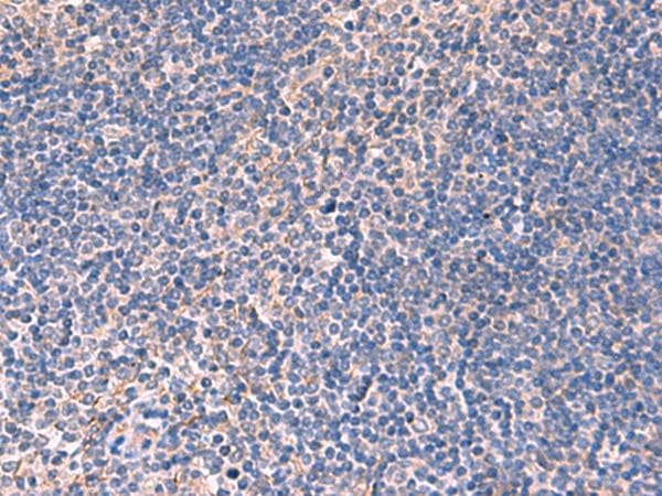 Polyclonal Rabbit anti-Human INPP5B Antibody (IHC)