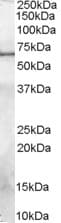 IHC-plus™ Polyclonal Goat anti-Human SPP1 / Osteopontin Antibody (aa288-299, IHC, WB)