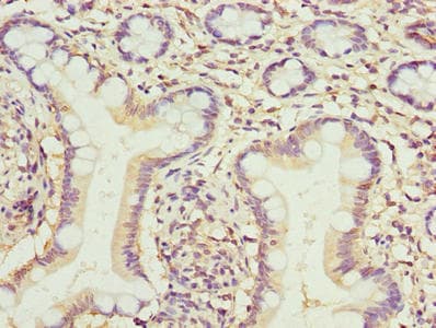 Polyclonal Rabbit anti-Human TMEM154 Antibody (IHC, WB)