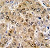 Polyclonal Rabbit anti-Human DDX5 Antibody (aa491-518, IHC, WB)