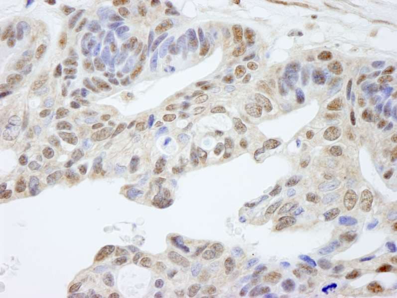 Polyclonal Rabbit anti-Human UACA Antibody (aa675-725, IHC)