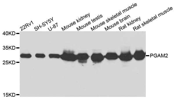 PGAM2 Antibody