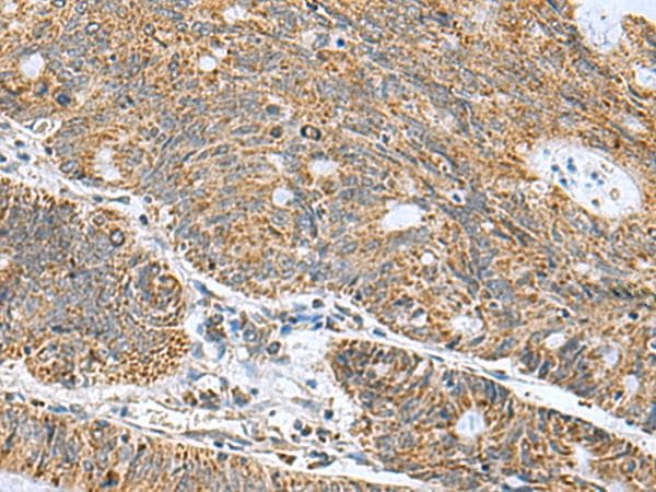 MRPL40 Antibody