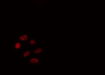 Polyclonal Rabbit anti-Human WTAP Antibody (IF, WB)